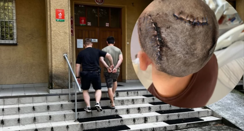 Brutalna napaść maczetą na Ukraińca. Trzech nastolatków zatrzymanych