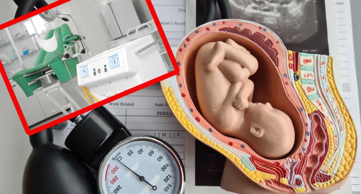 Stanowisko MZ: legalna aborcja możliwa nawet w 36. tygodniu ciąży