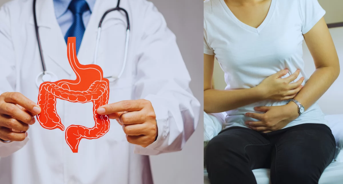 Zespół jelita drażliwego. Kryteria diagnostyczne i objawy alarmowe