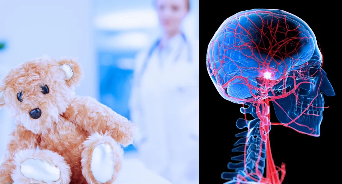 Objawy udaru mózgu u dzieci i młodzieży. Co powinni wiedzieć rodzice