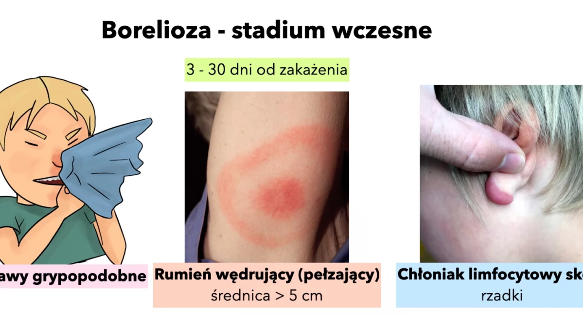 Słupsk uruchamia program profilaktyki boreliozy dla mieszkańców