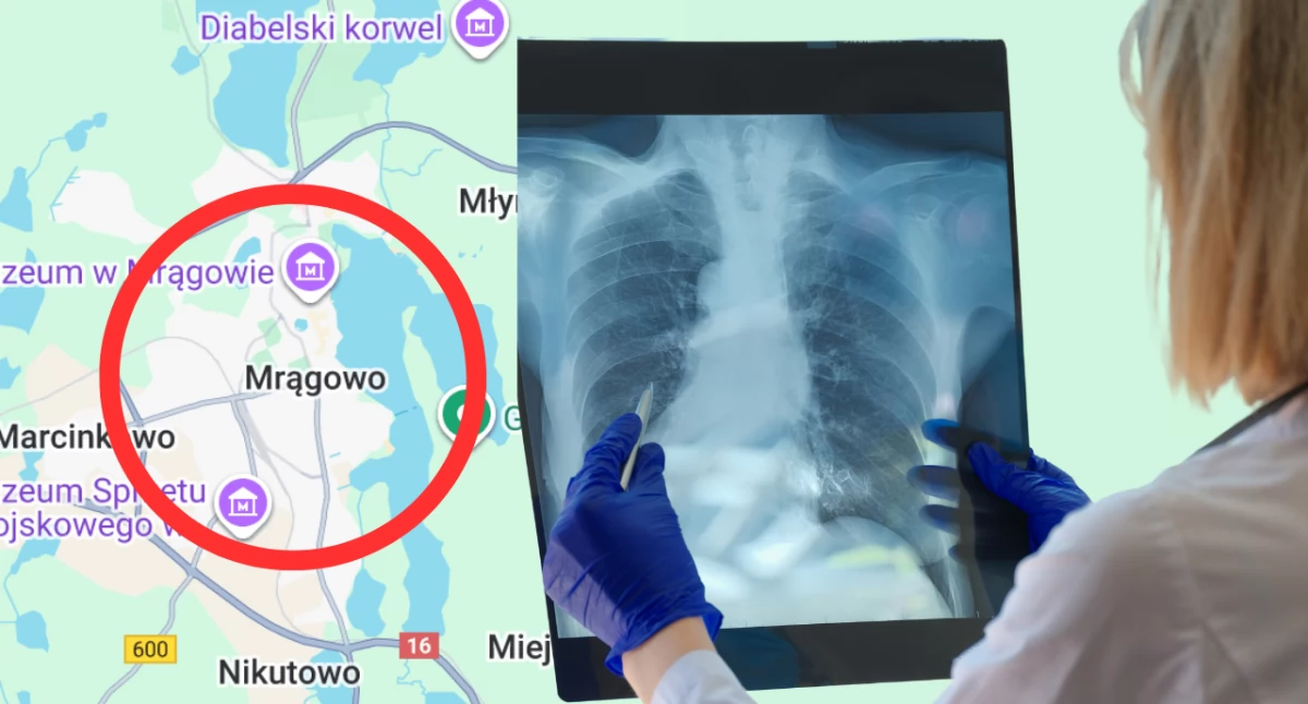 Gruźlica w szkole podstawowej w Mrągowie. Sanepid ustala setki kontaktów z chorą nauczycielką