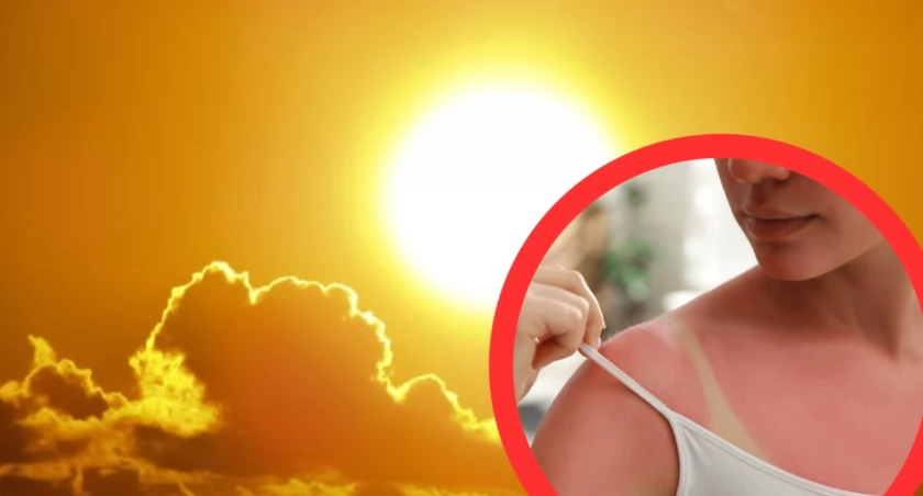 Wysoka temperatura i oparzenie słoneczne mogą prowadzić do udaru i czerniaka