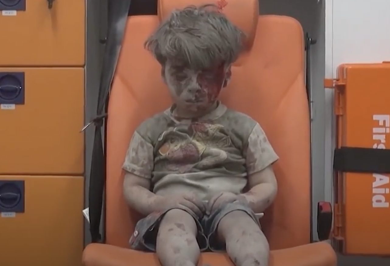 Dziecko, które padło ofiarą wojny domowej w Syrii 