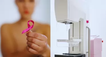 Rak piersi zabija kobiety w Polsce. Mammografia za darmo może uratować życie