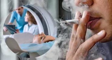 Palisz papierosy? To badanie może uratować Ci życie. I jest darmowe