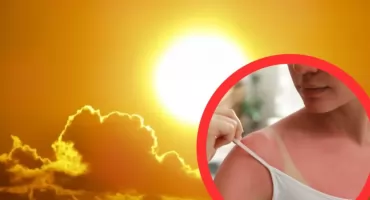 Czerniak i oparzenia słoneczne. Eksperci alarmują przed falą upałów